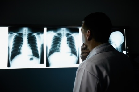 lung disease