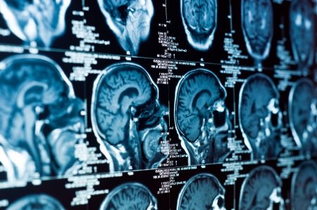 Brain Damage Offshore maritime